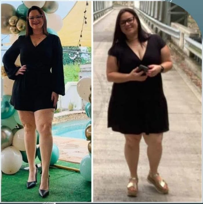 Before and after comparison showing a woman in a black wrap dress, left photo at an event, right photo on a city street