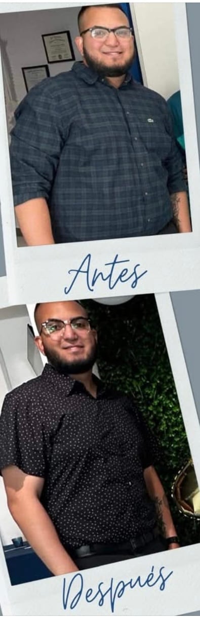 Before and after photos showing a mans weight loss transformation, labeled Antes and Despues